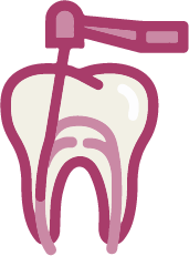Endodoncia en Sabadell