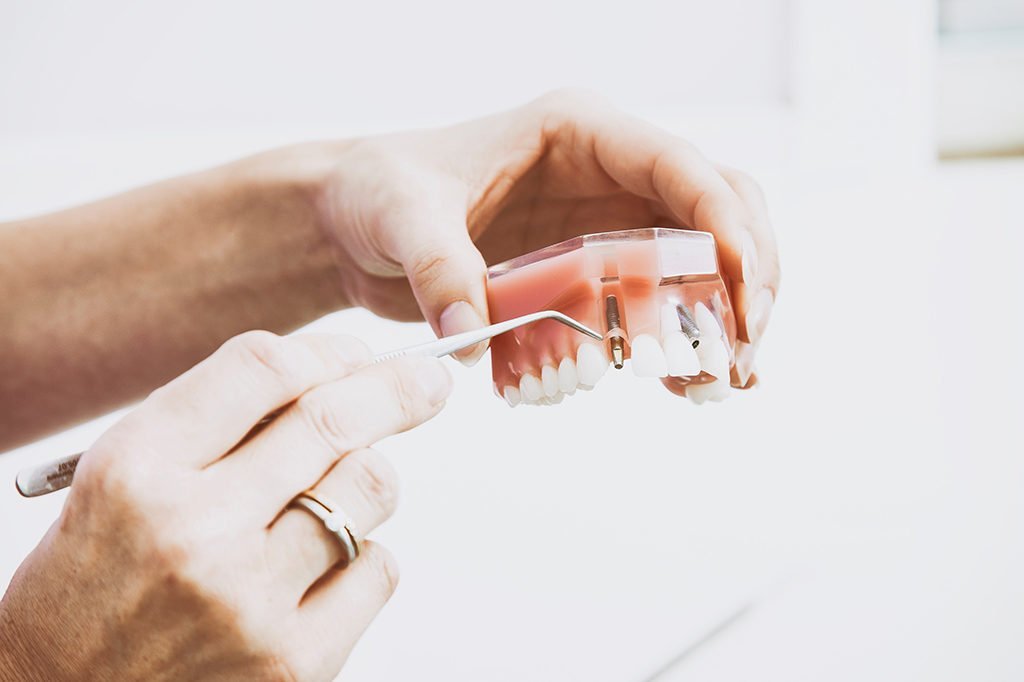 salud periodontal en verano periodontitis